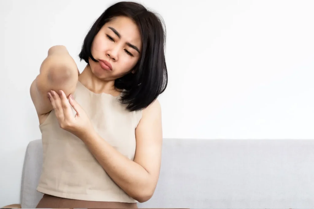 Skin Bleachings Treatment in Ventura, CA | IWH MedSpa