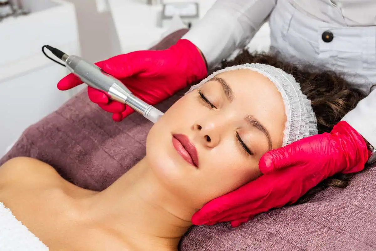 Microneedling in Ventura, CA | IWH Medspa