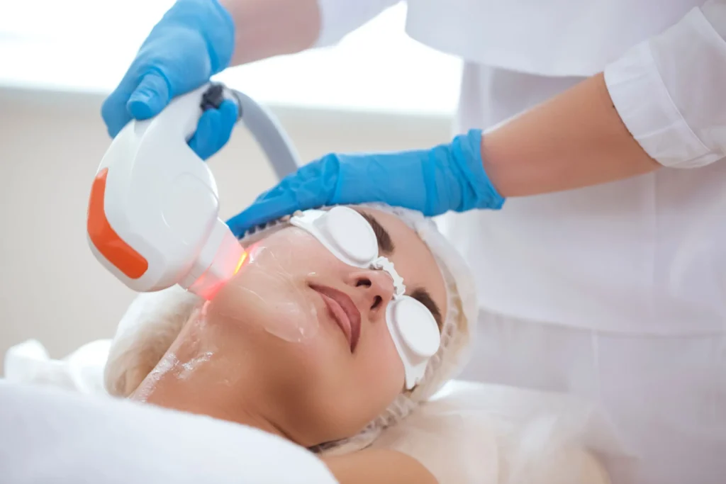 IPL Treatment in Ventura, CA | IWH Med Spa