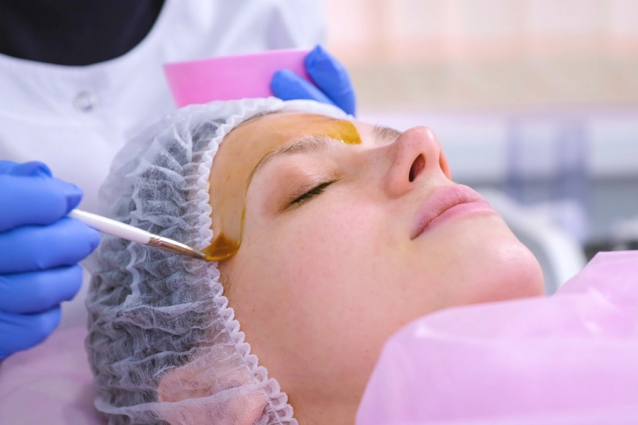 VI Peel in Ventura, CA | IWH MedSpa