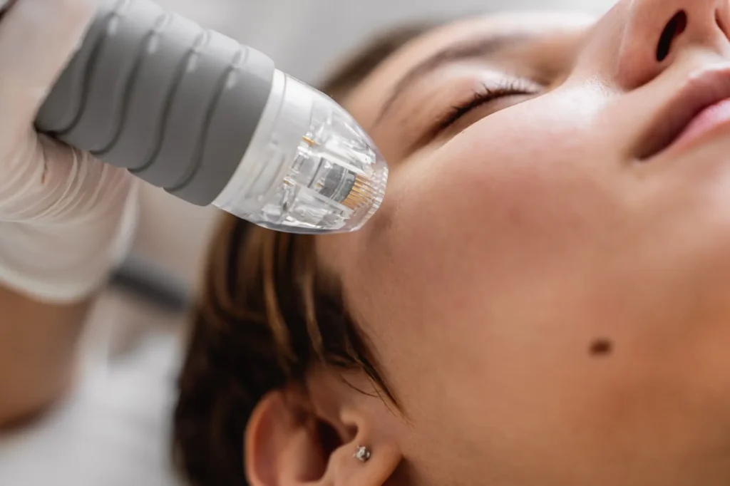 Topical Retinols in Ventura, CA | IWH MedSpa