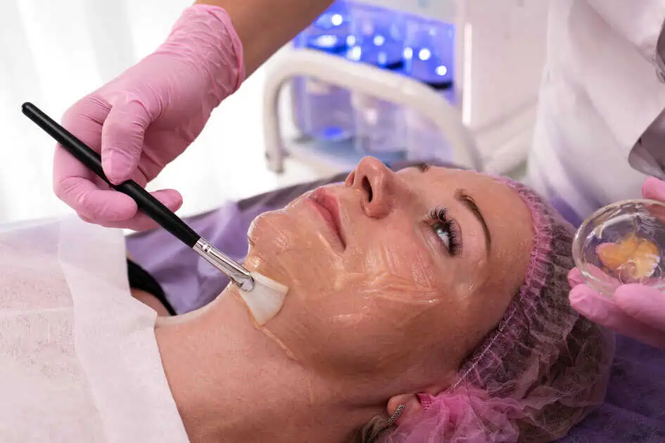 Vi Peel by deal Women's Health Specialists in Ventura, CA