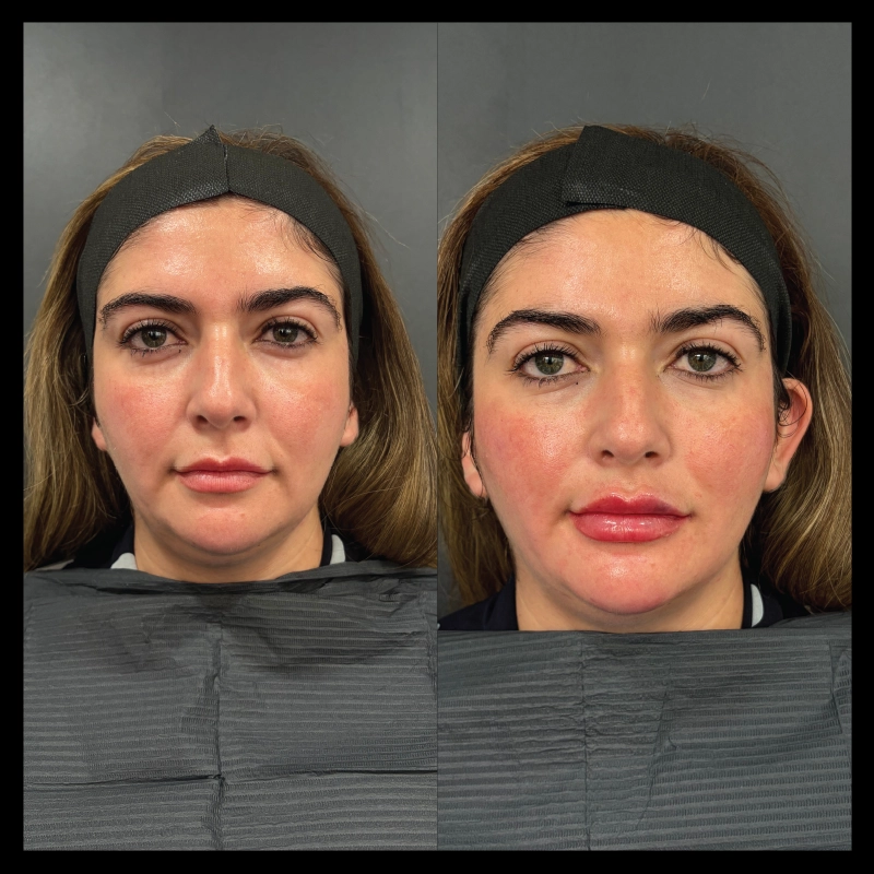 Before-After_1
