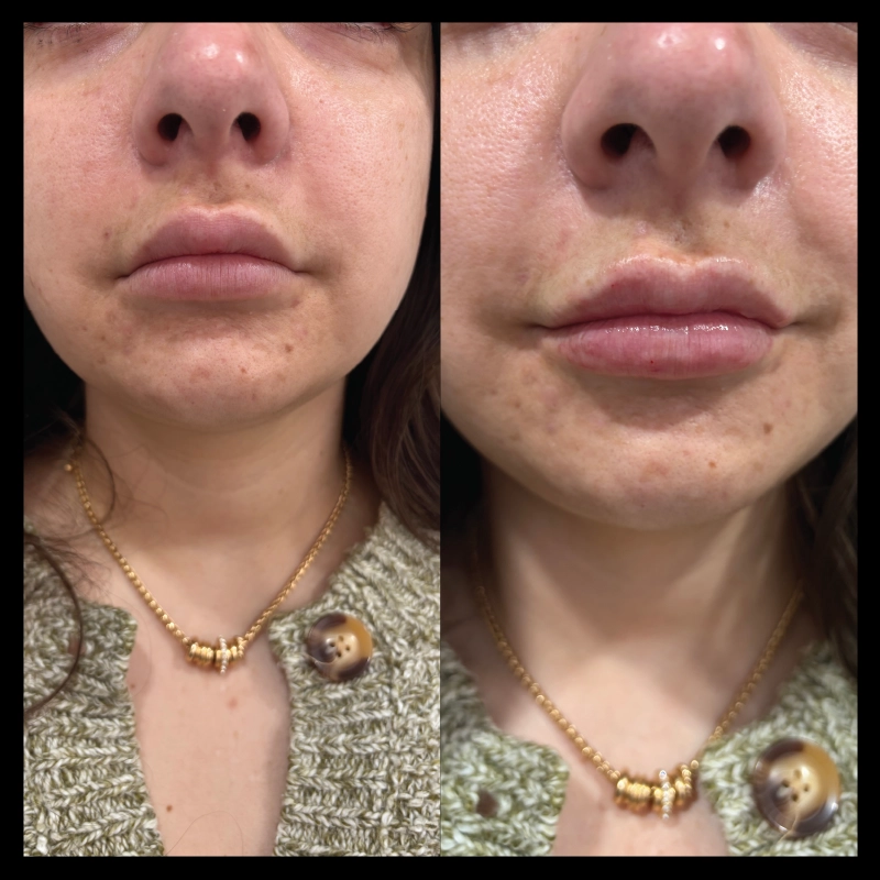 Before-After_2