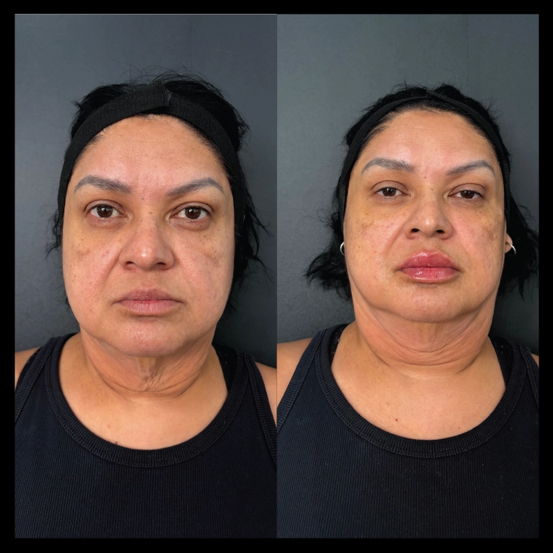 Before-After_3