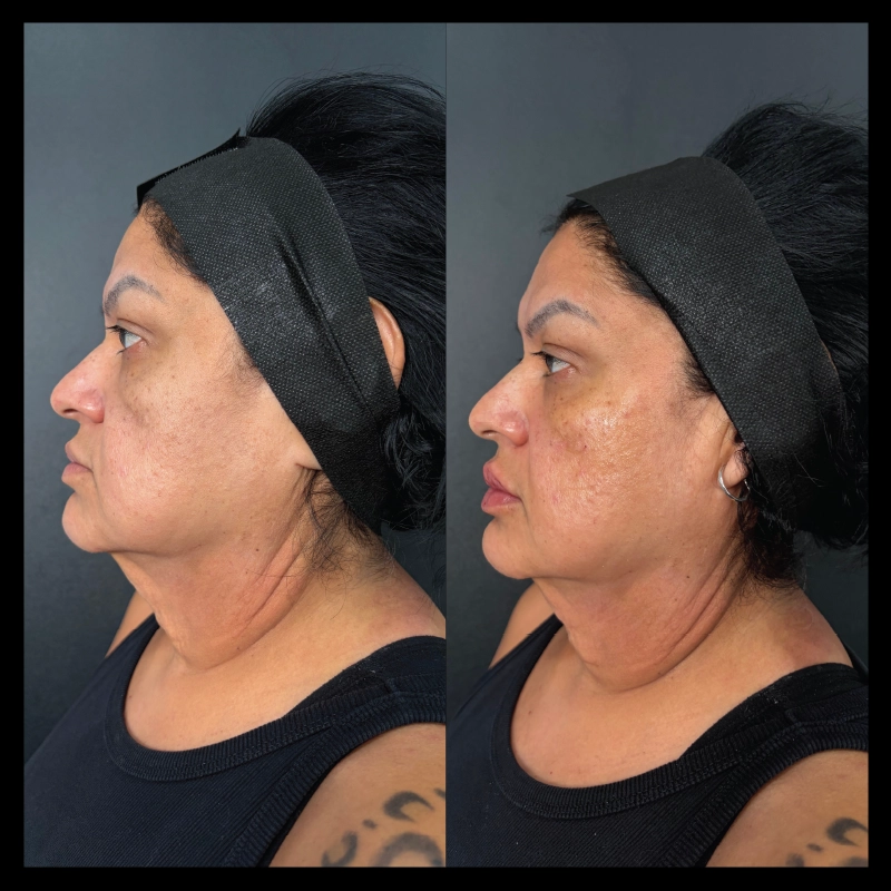 Before-After_4